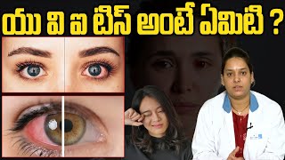 యు వి ఐ టిస్ అంటే ఏమిటి ? Uveitis | Causes, Signs, Symptoms, Diagnosis \u0026 Treatment | hmtv healthplus