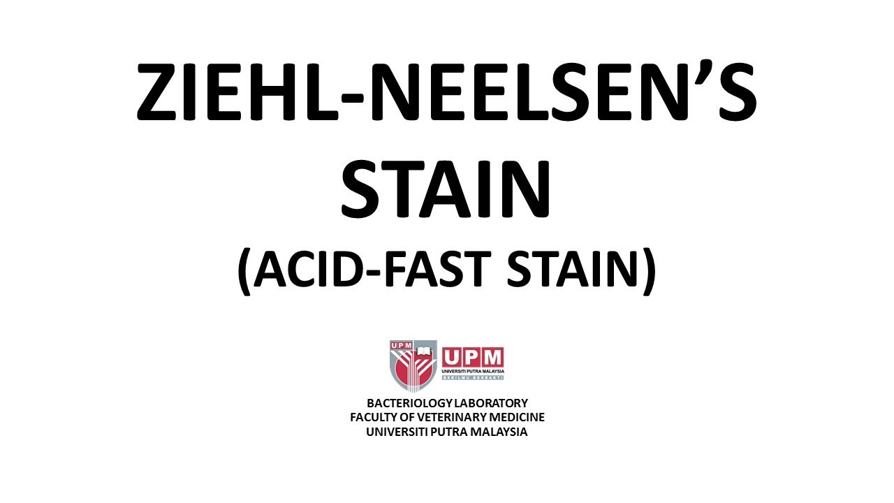 Ziehl Neelsen Stain (Acid-Fast Stain) - Principle, Procedure And ...