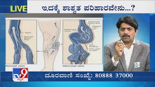 Nimma Doctor | Treatment For Varicose Veins | AVIS Hospital