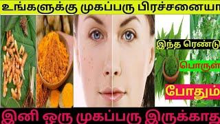 முகப்பரு,கருமை,கரும்புள்ளிகள் ஒரே நாளில் நீங்க|Remove pimples overnight homeremedies in tamil #viral