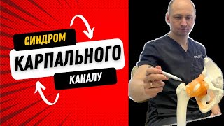 Біль в кистях !! Оніміння пальців !! Синдром карпального каналу !! Як лікувати?