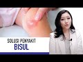 Boils: Symptoms, Causes and How to Treat Them | Kata Dokter