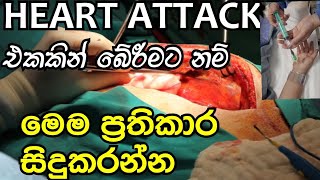 Heart Attack පිළිබඳ ඔබ දැනගතයුතු සැත්කම් හා ප්‍රතිකාර