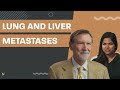 Liver and Lung Mets | Advanced #ProstateCancer | MarkScholzMD | AlexScholz #PCRI