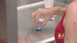 Some State Lawmakers Support Supervised Injection Sites