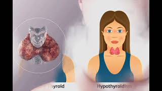 Thyroid Leiba Meeoisingna Chaba Yaba||Yadaba|| Hypothyroidism ||Manipur👩‍⚕️