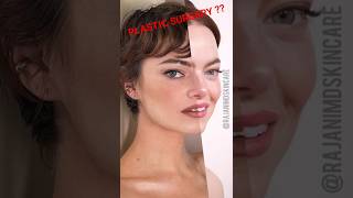Emma Stone Plastic Surgery Face Transformation