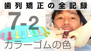 カラーモジュール（ゴム）の色選び＆取り付けの様子｜歯列矯正の全記録7-2