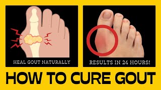 🌟Unlock the Secret: How to Heal Gout Naturally in Just 24 Hours!