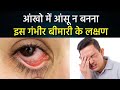 आंखों में आंसू न आना Dry Eye Syndrome के लक्षण,क्या है कारण और बचाव | Boldsky