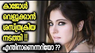 സൗന്ദര്യത്തിന് വേണ്ടി കാജോള്‍ ശസ്ത്രക്രിയ നടത്തി, എന്തിനാണെന്നറിഞ്ഞാല്‍ കൗതുകം തോന്നും? Kajol