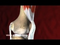 3D VEDIO FOR KNEE JOINT