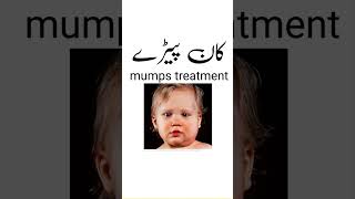 Kan Pere Ka Ilaj | Mumps Treatment in Urdu | Kanfed ka ilaj | Kan Paray ka ilaj #youtubeshorts