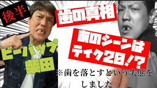 ビーバップハイスクール柴田氏の歯の真相！当時遊んでたアイドルは？！