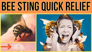 Honey Bee Sting Treatment At Home - Quick Relief for Bee Stings