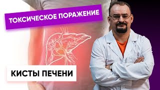 Токсическое поражение печени. Кисты печени