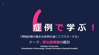 症例で学ぶ神経診療の基本：変な脳梗塞の鑑別！