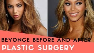Beyonce Before and After Plastic Surgery
