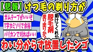 【2ch面白いスレ】【悲報】ワイ、けつ毛の剃り方がわからず今の今まで生やし続ける【ゆっくり解説】