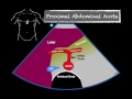 Bedside Ultrasound Abdominal Aorta