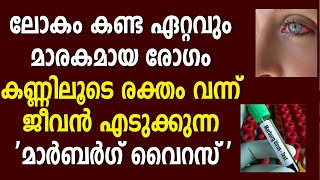 മാർബർഗ് വൈറസ് ടാൻസാനിയയിലും; എട്ട് പേർ മരിച്ചതായി ലോകാരോഗ്യ സംഘടന | MARGURG വൈറസ്