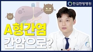 A형간염은 간암과 연관성이 있다? 없다?