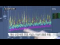 고통스런 만성 통증…대뇌 신경 이상이 유발 ytn 사이언스