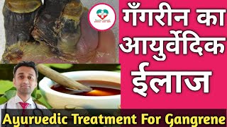 Gangrene Ayurvedic Treatment! गँगरीन का आयुर्वेदिक ईलाज क्या है? कैसे किया जाता है? Dr.K.S.Chougule.