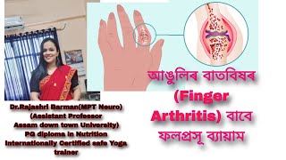 আঙুলিৰ বাতবিষৰ (Finger Arthritis) বাবে ফলপ্ৰসূ ব্যায়াম