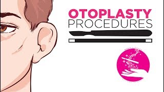 Otoplasty MagicSurgeon The Video Series