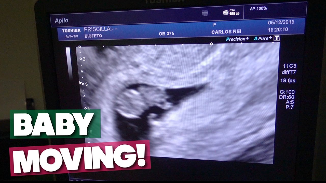 8 WEEK ULTRASOUND! BABY ALREADY MOVING!!! - YouTube