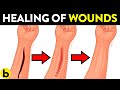 How Does Your Body Heal Cuts & Wounds?