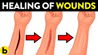 How Does Your Body Heal Cuts & Wounds?