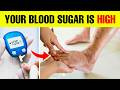 16 Signs Your Blood Sugar Is High & 8 Diabetes Symptoms