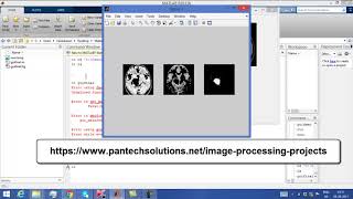 Matlab code for Kmeans Segmentation
