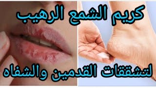 كريم الشمع والنشا الرهيب لتشققات القدمين🦶 والشفاه💋إلى جربتيه عمره يخطاك في هاد البرد القارس