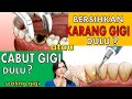 CABUT GIGI dulu atau bersihkan KARANG GIGI (scaling) dulu❓🤔