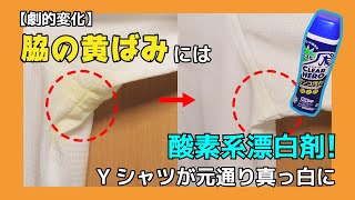 【劇的変化】脇の黄ばみには酸素系漂白剤！Yシャツが元通り真っ白に