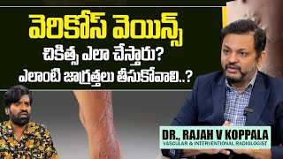 Varicose Veins Symptoms \u0026 Treatments | Dr. Rajah V Koppala | Avis Hospital