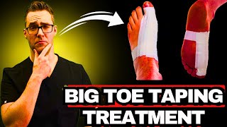 How To Tape A Sprained Big Toe Joint [Turf Toe Taping Treatment]
