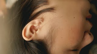 What is a perforated eardrum? | Patient Explainers