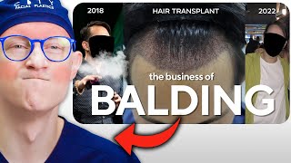 Hair Surgeon Reacts to Dreadful Business of Balding and Hair Loss