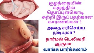 குழந்தையின் கழுத்தில் தொப்புள் கொடி/Cord around baby neck in tamil/Cord reasons \u0026 how to avoid tamil