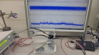 樹脂容器を利用した、メガヘルツの超音波システムーー超音波発振制御技術の応用ーー（超音波システム研究所）