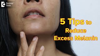 5 TIPS TO REDUCE EXCESS MELANIN | Reduce Melanin in Body Permanently-Dr.Divya Sharma|Doctors' Circle