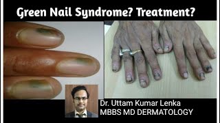 #Nail #Skin #Fungal #SkinCare          Green Nail Syndrome || Dr Uttam Lenka ||