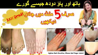 INSTANT HANDS, FEET, KNUCKLES WHITENING in 5 MINUTES in URDU / HINDI | DR BILQUIS SHAIKH