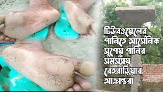 টিউবওয়েলের পানিতে আর্সেনিক, সুপেয় পানির সমস্যায় বেতবাড়িয়ার  আক্রান্তরা ।