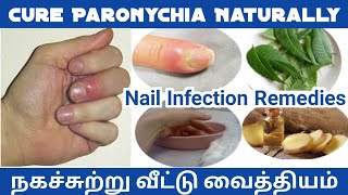 நகச்சுற்று மறைய | Nail Infection Remedies | Cure Paronychia Naturally | Health Care Tamil