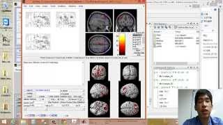 [2014.6.4 Lesson15-session3]VBM分析處理與統計